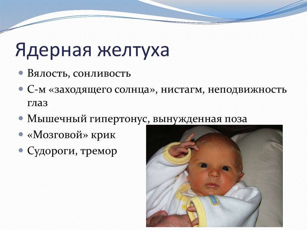 Билирубин у новорожденных, норма, осложнения, необходимое лечение