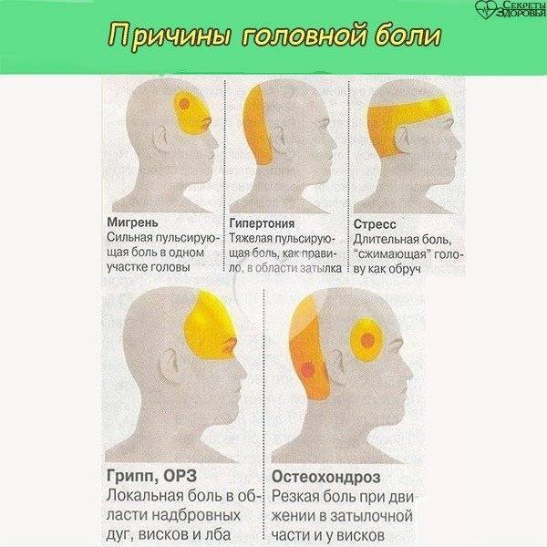 Посттравматическая головная боль - лечение, симптомы, причины, диагностика | центр дикуля