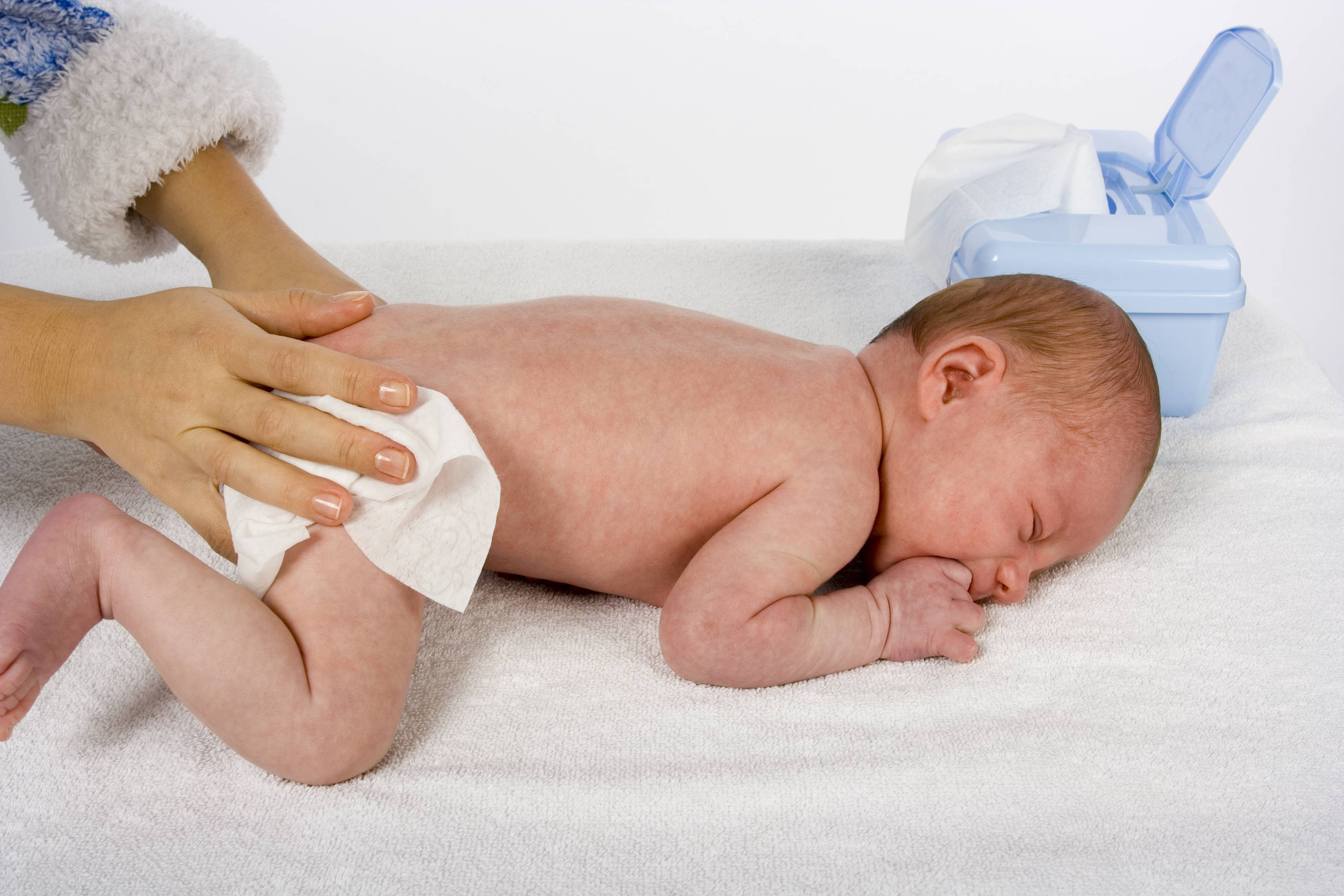 Сильные опрелости у новорожденных (лечение)
