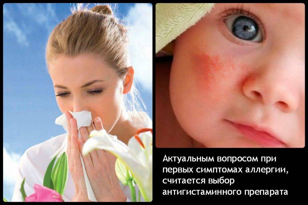 Пищевая аллергия у детей до года