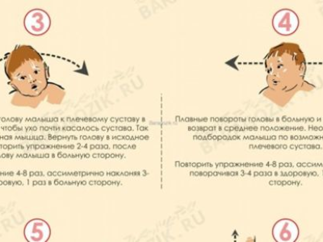 Кривошея у грудничков: причины и методы лечения (массаж\гимнастика)