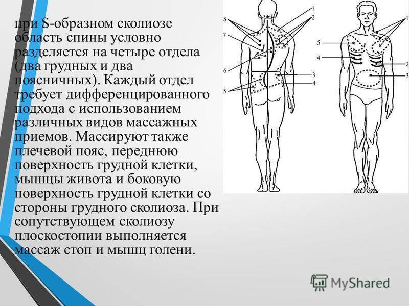 Массаж при сколиозе. Методика массажа при сколиозе у детей. Массаж при сколиозе позвоночника. Массаж при сколиозе у детей.