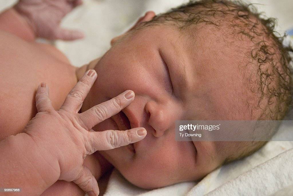 Щетина у младенцев