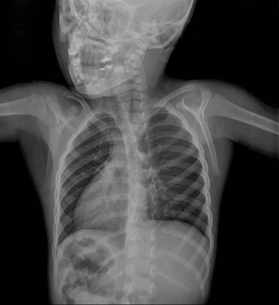 Опасность рентгена при беременности - рентген легких, зуба, носа на раннем и позднем сроке беременности :: polismed.com