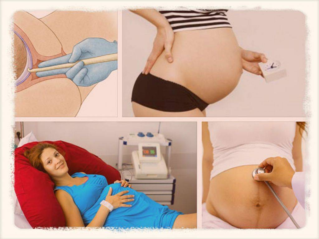 Через какое время после снятия пессария начинаются роды - о беременности