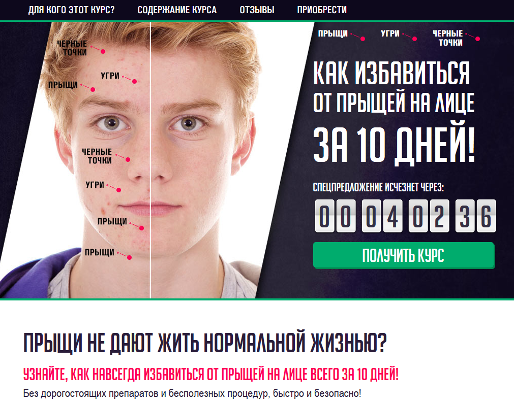Прыщи у подростка: как лечить высыпания