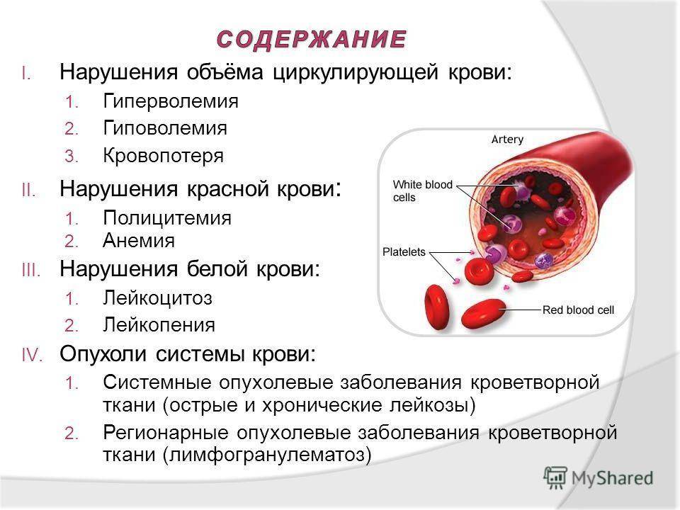 Заболевания крови презентация