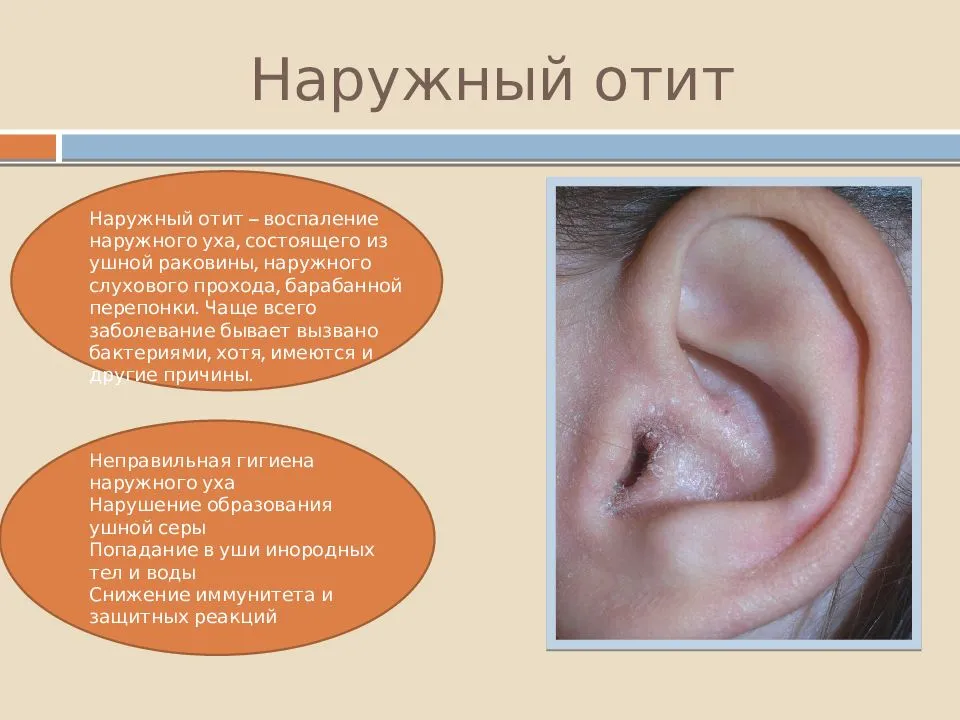 Заложенность уха