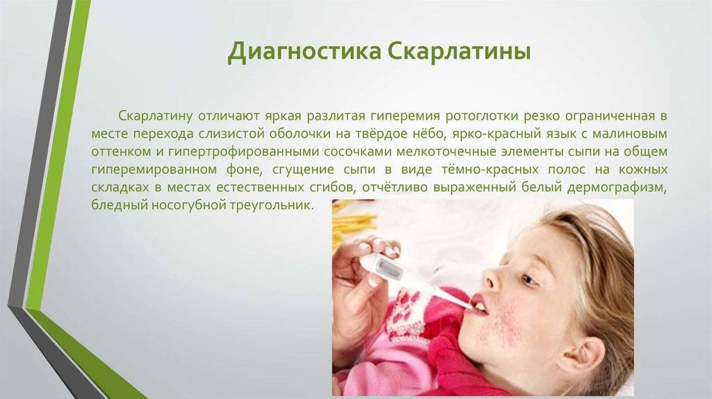 Скарлатина у детей – этапы болезни, классификация видов, протекание заболевания | см-клиника