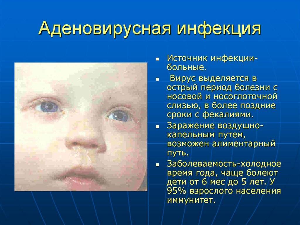 Лечение конъюнктивита глаз у детей и взрослых. как и чем лечить: капли и мази - medside.ru