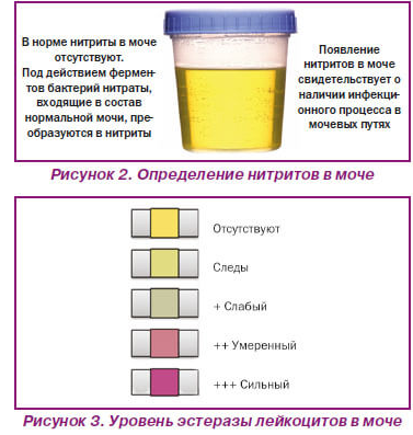 Смочь нормальный. Цвет мочи. Моча нормального цвета. Темный цвет мочи. Цвет мочи норма.