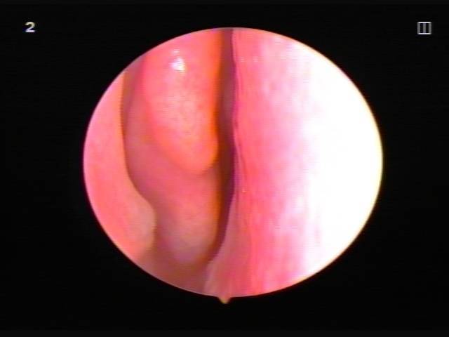 Зуд половых губ - самые частые причины и как его предотвратить? * клиника диана в санкт-петербурге