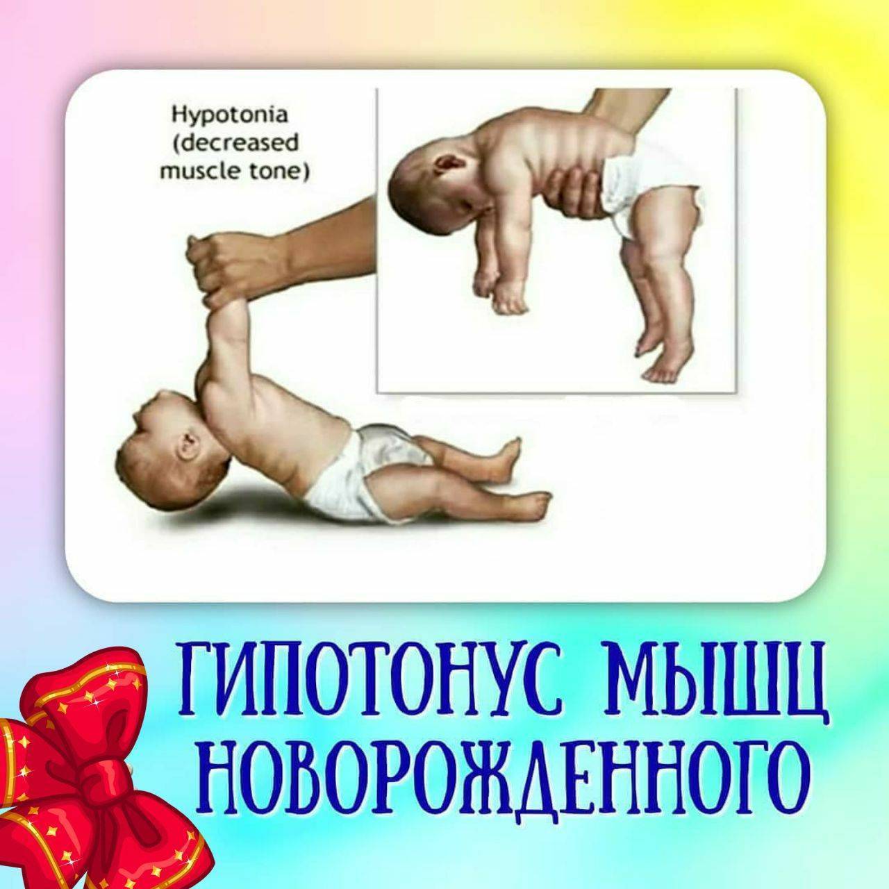 Cиндромы двигательных расстройств (мышечная дистония, дцп)
