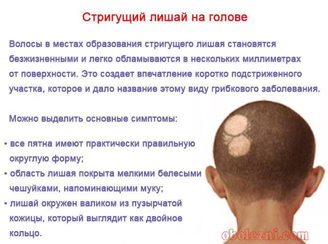 Стригущий  лишай