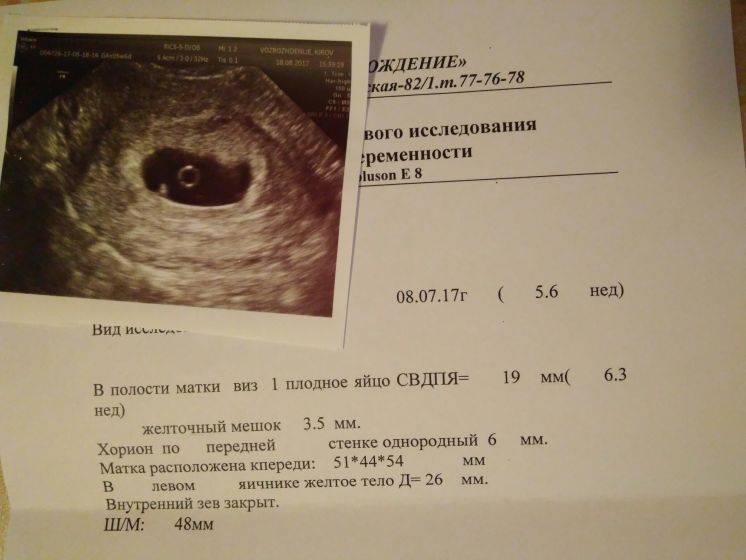 Когда на УЗИ видно плодное яйцо, почему эмбрион не визуализируется на сроке 6–7 недель беременности?