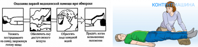 Как правильно оказать первую помощь при обмороке