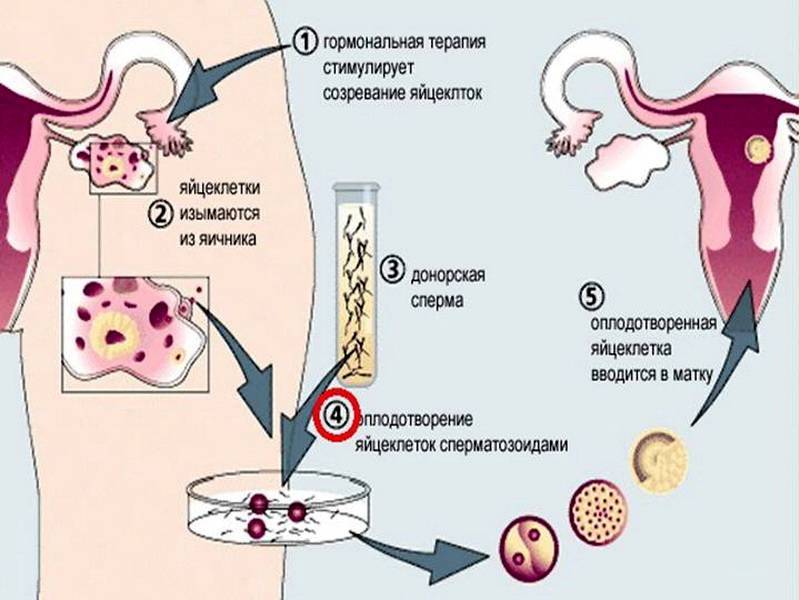 Криоперенос после неудачного эко: когда делать  - статья репродуктивного центра «за рождение»