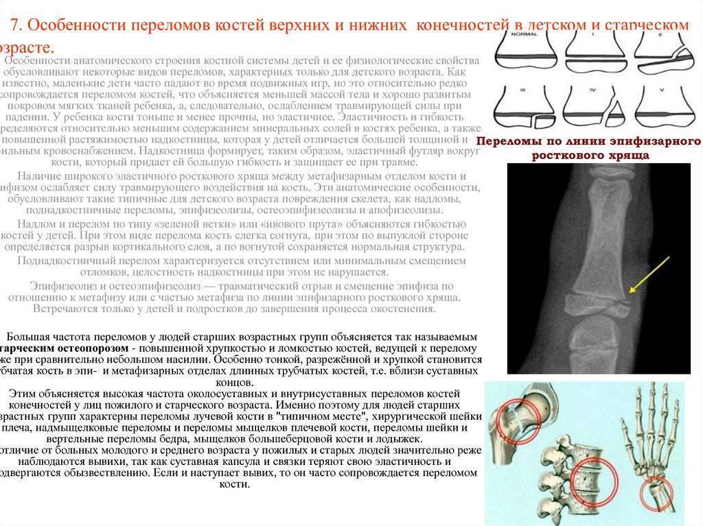 Переломы плечевой кости - симптомы болезни, профилактика и лечение переломов плечевой кости, причины заболевания и его диагностика на eurolab