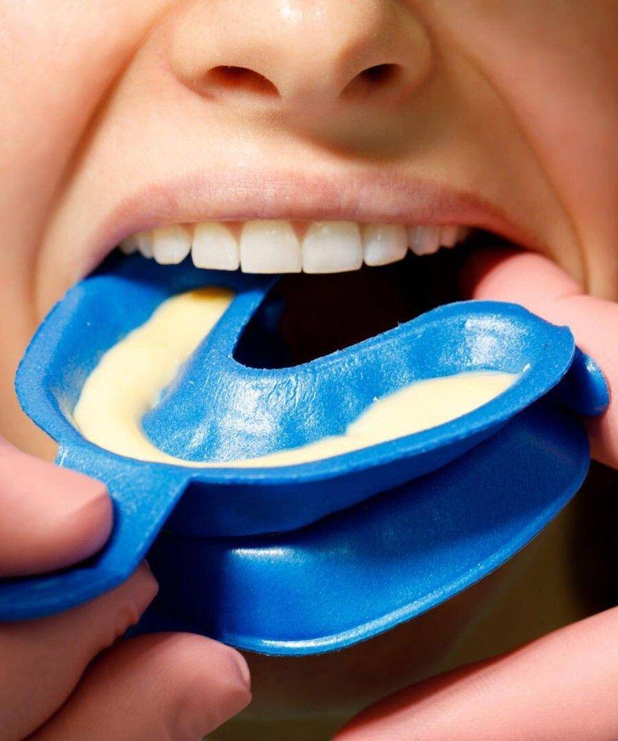 Фторирование зубов детям | рекомендации и противопоказания - центр стоматологии «тихонова» в туле