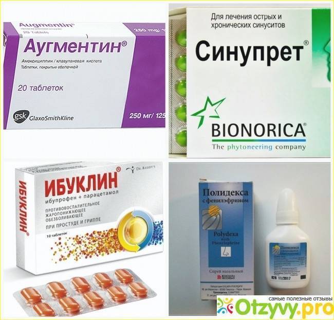 Как лечить вазомоторный ринит: хроническая и аллергическая формы, препараты, капли