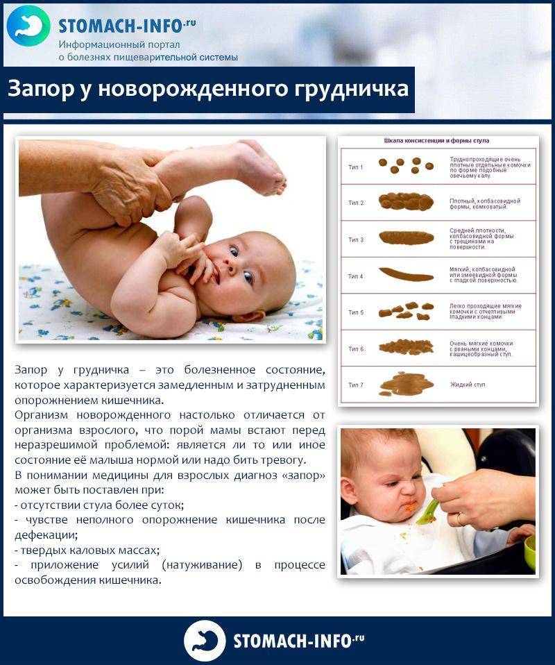Нарушения стула у новорожденных