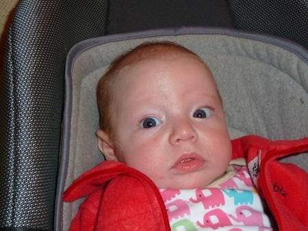 Когда проходит косоглазие у новорожденных и почему у грудничков косят глазки?