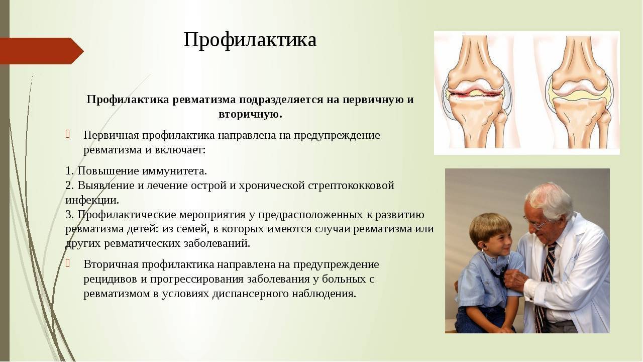 Ревматоидный артрит у детей