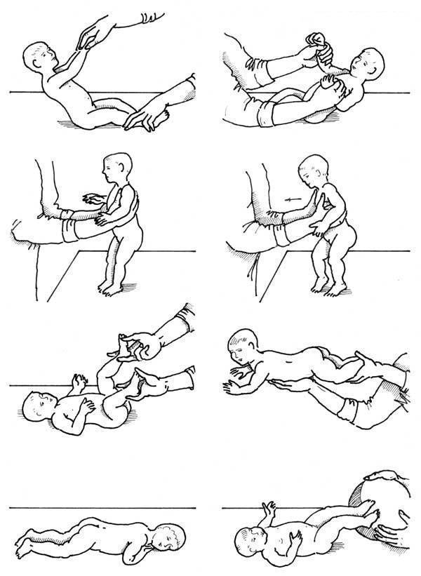 Гипотонус у грудничка (Комаровский): признаки, массаж, лечение ребенка