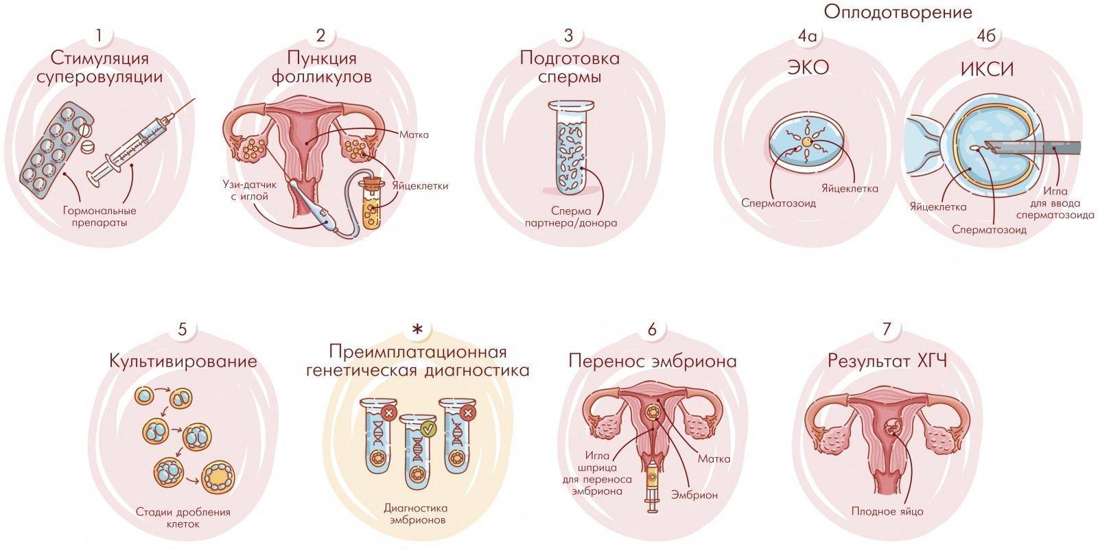 ᐈ перенос эмбрионов в полость матки (iv этап программы эко) в клинике репродукции iclinic в спб