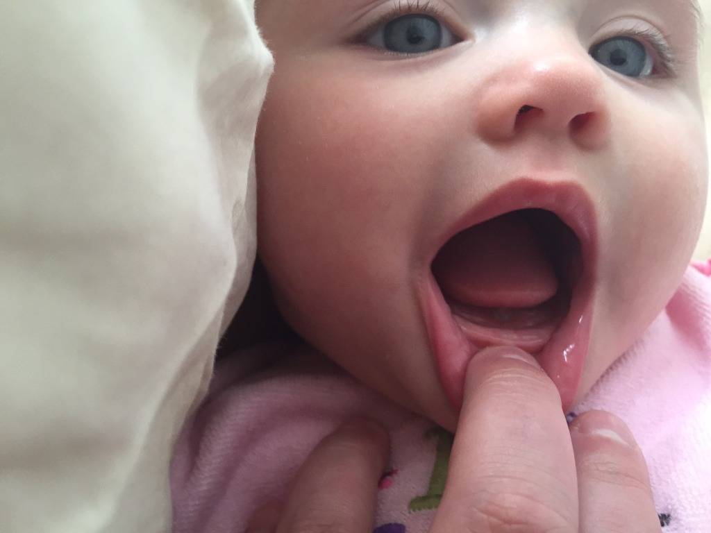 Первые зубы у младенцев: во сколько месяцев начинают прорезываться зубы, какие зубы у младенцев появляются первыми и сколько длится прорезывание молочных зубов у детей? как облегчить боль малышу при п