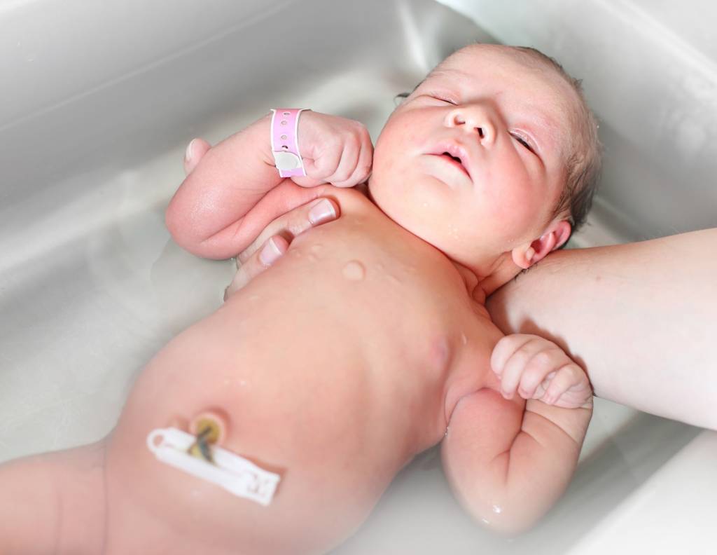 Мокнет пупок у новорожденного: что делать, как обрабатывать?