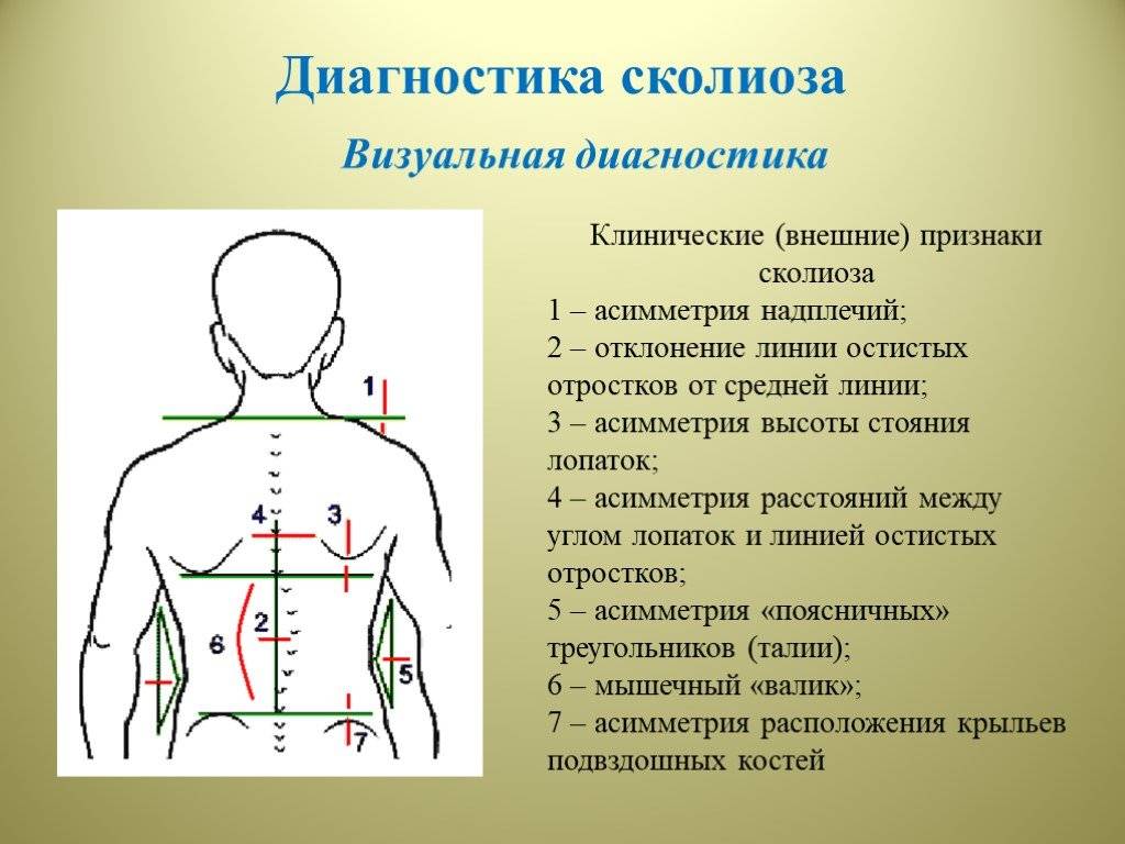 Позвоночник школьников - ау "республиканский центр мануальной терапии" минздрава чувашии