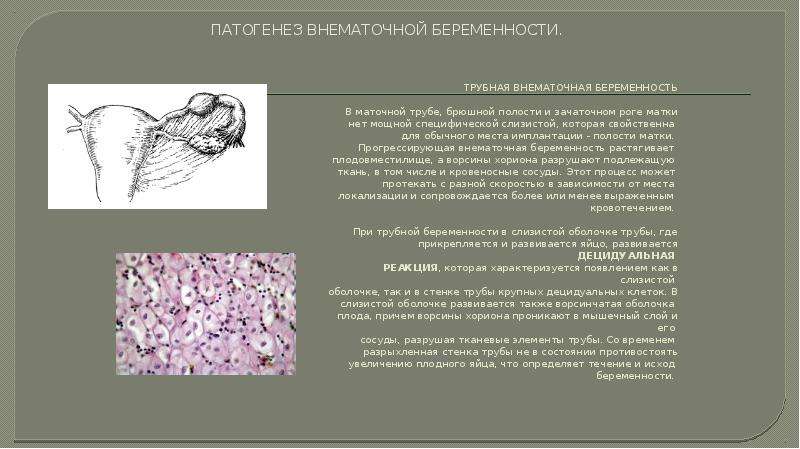 Загиб матки - можно ли забеременеть при загибе матки вправо или влево | национальный центр репродукции «эко-содействие»