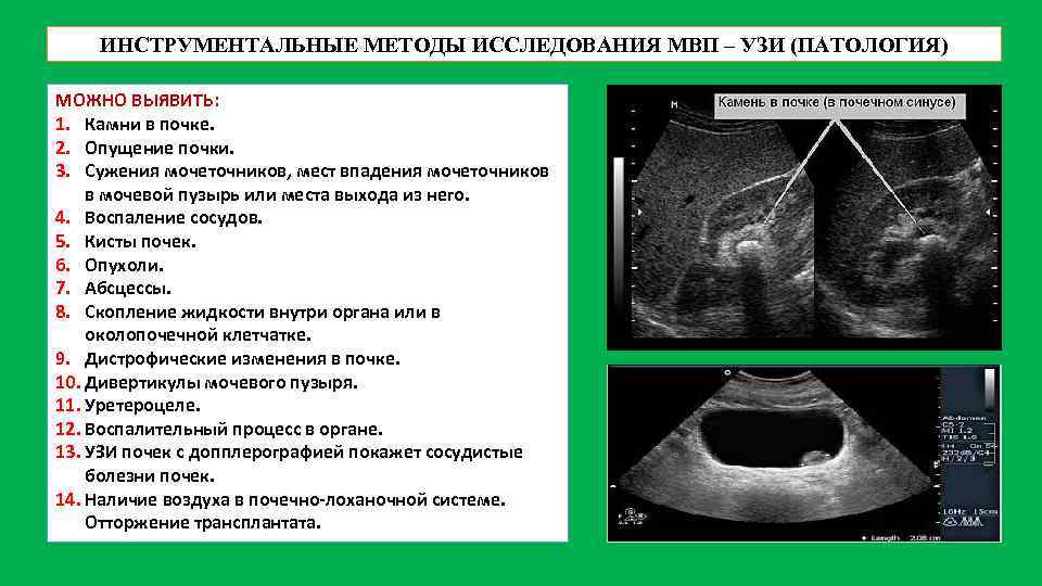 Узи почек и мочевого пузыря презентация