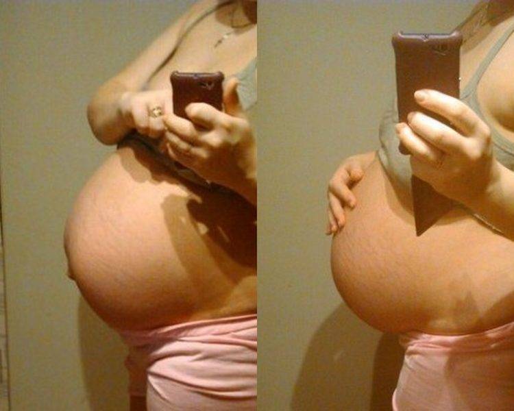 Опустился живот когда рожать: за сколько до родов опускается, когда опускается у беременных, как понять | rucheyok.ru