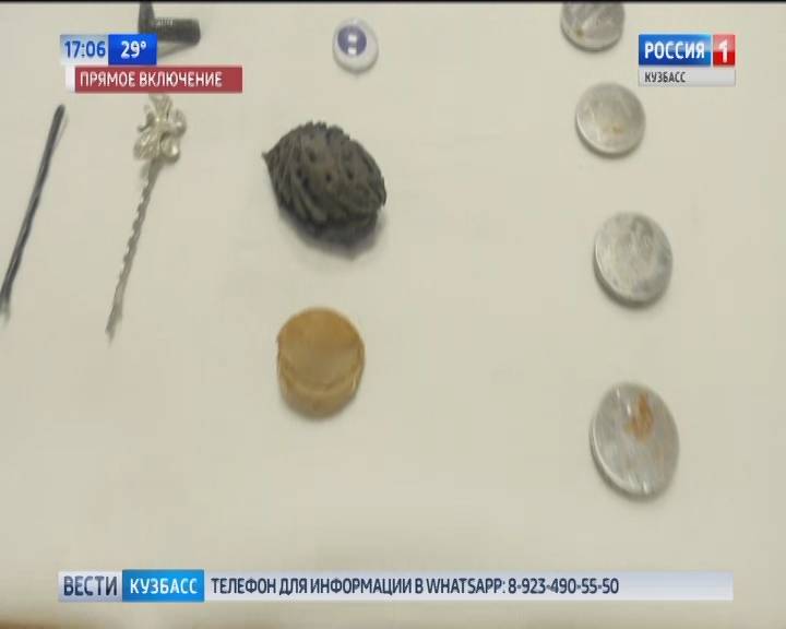 Инородное тело у детей в пищеводе или желудке - в чем риски, когда нужна помощь