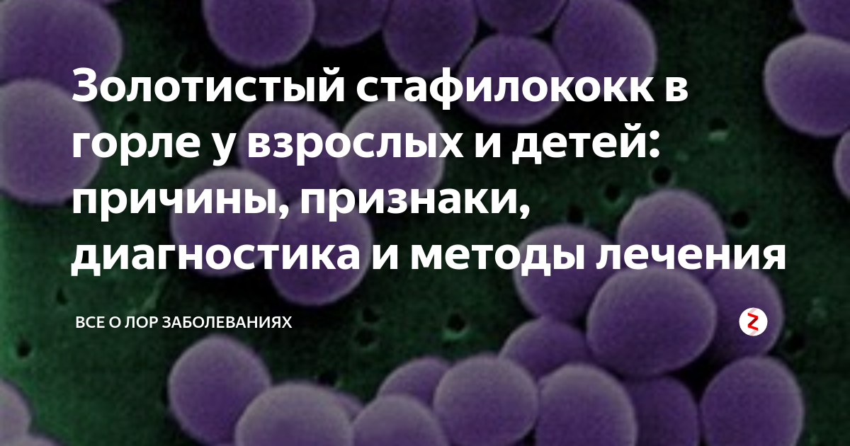 Чем лечить золотистый стафилококк. Стафилококк в носоглотке. Золотистый стафилококк в горле. Стафилококковая инфекция в носоглотке.