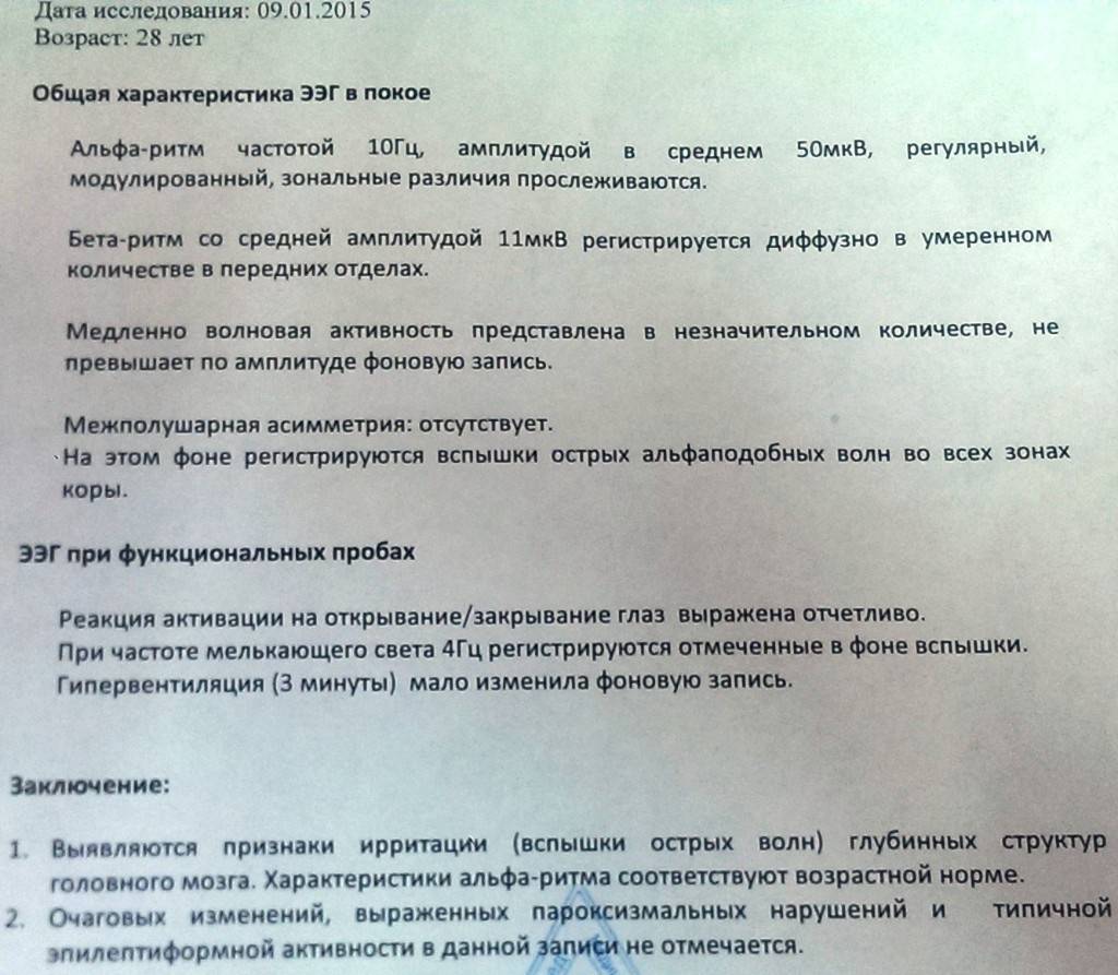Электроэнцефалография (ээг)