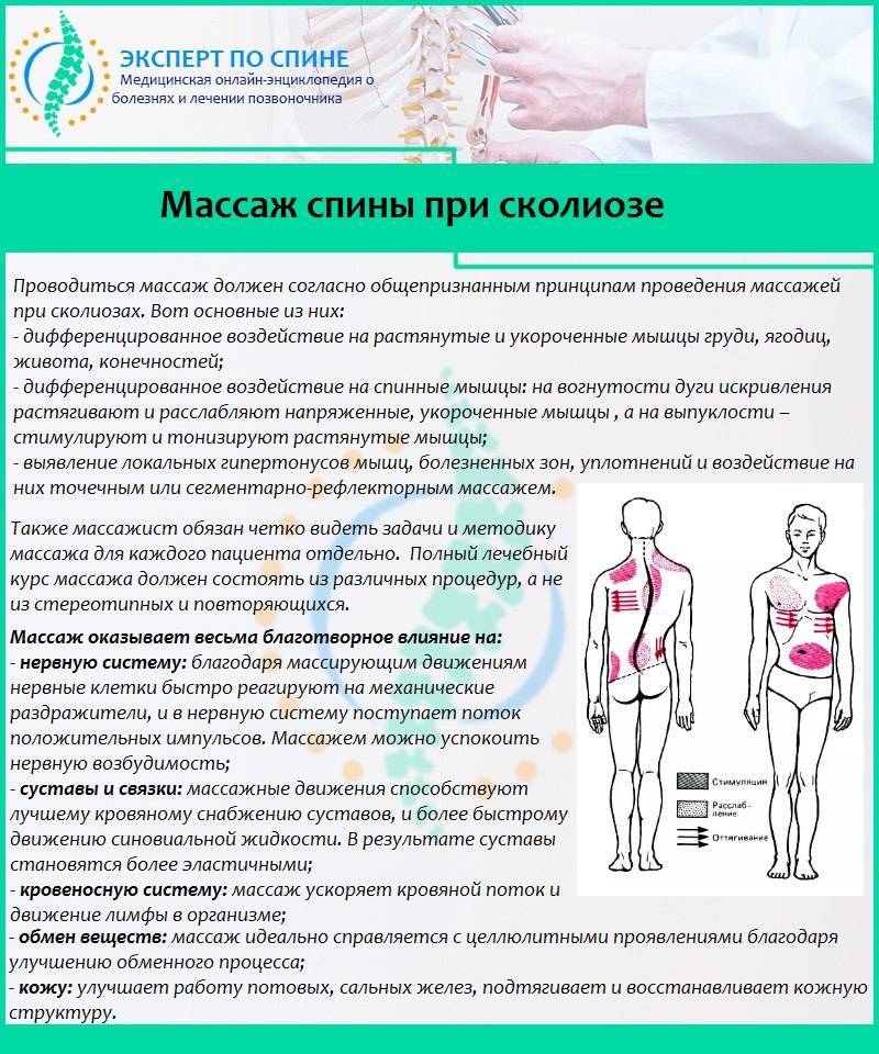 Нарушение осанки у детей - причины, виды, профилактика и реабилитация