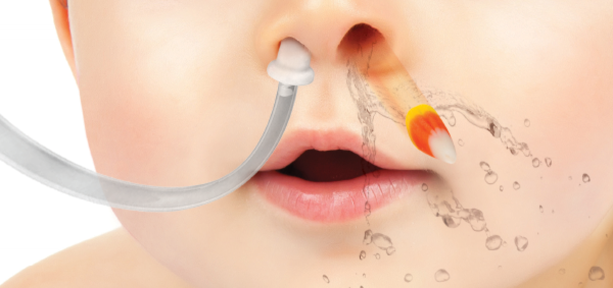 Первая помощь при попадании инородного тела в нос: правила оказания | food and health