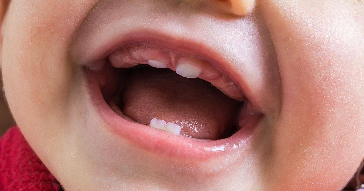 ᐈ потемнение зуба у ребенка: почему случается и что делать