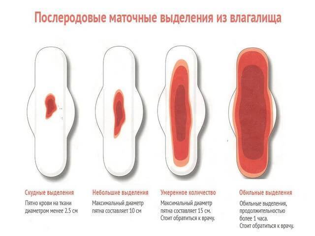 Как ухаживать за собой после кесарева сечения