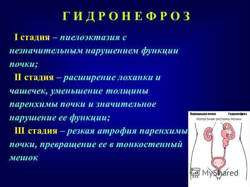 Пневмония: симптомы и лечение воспаления лёгких у взрослых и детей, профилактика заболевания