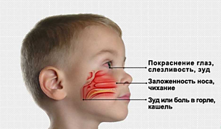 Противовирусные от насморка для детей: что делать если у ребенка насморк и кашель