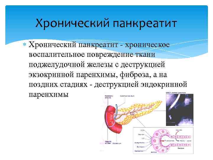 Диффузные изменения поджелудочной. Паренхиматозная ткань поджелудочной железы. Диффузные изменения поджелудочной железы. Изменения паренхимы поджелудочной железы. Диффузная поджелудочная железа что это.