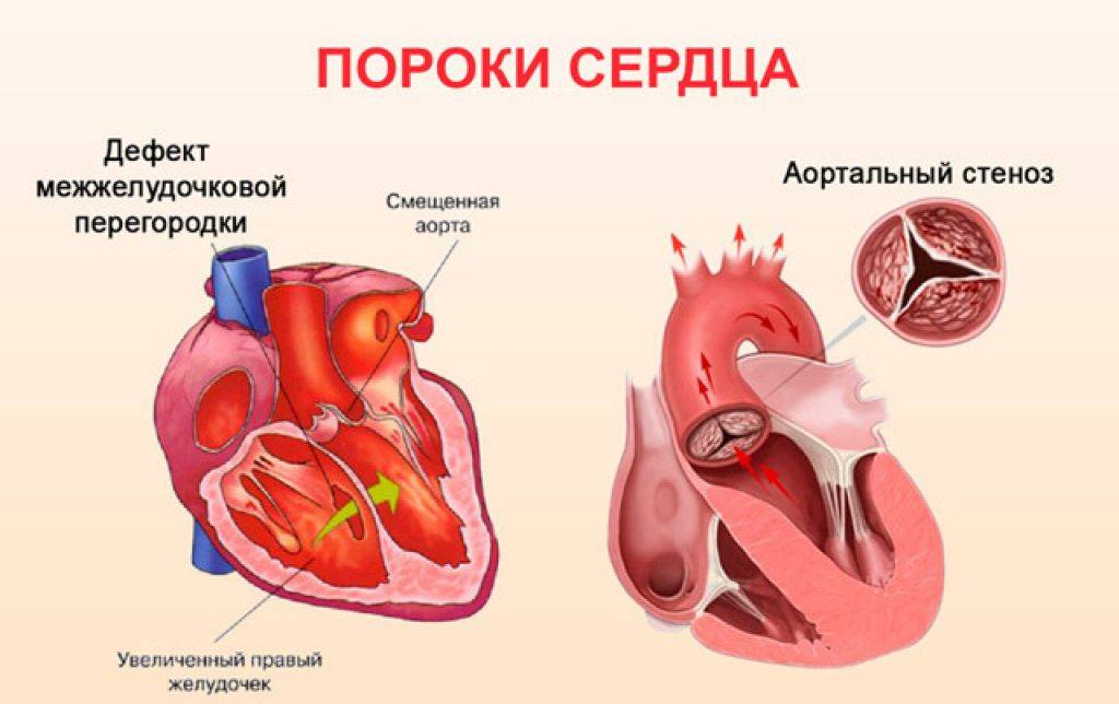 Kardi.ru - heart control -