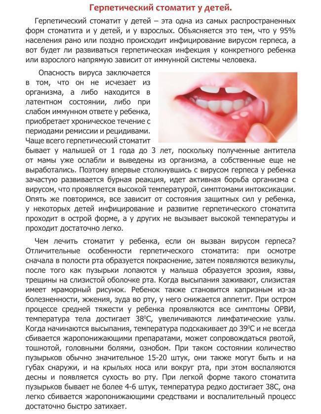 Опухла щека: причины, первая помощь, методы лечения