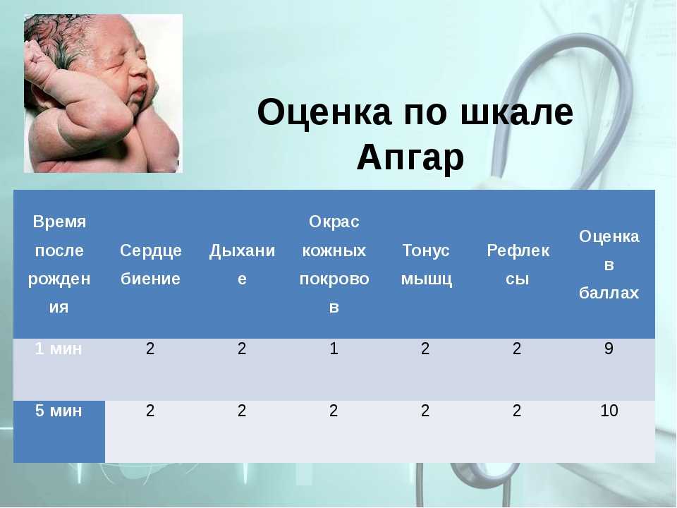 Шкала апгар для новорожденных: критерии, таблица, расшифровка