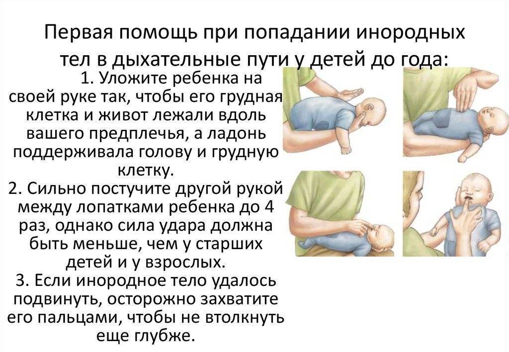 Что делать если новорожденный подавился молоком: первая помощь