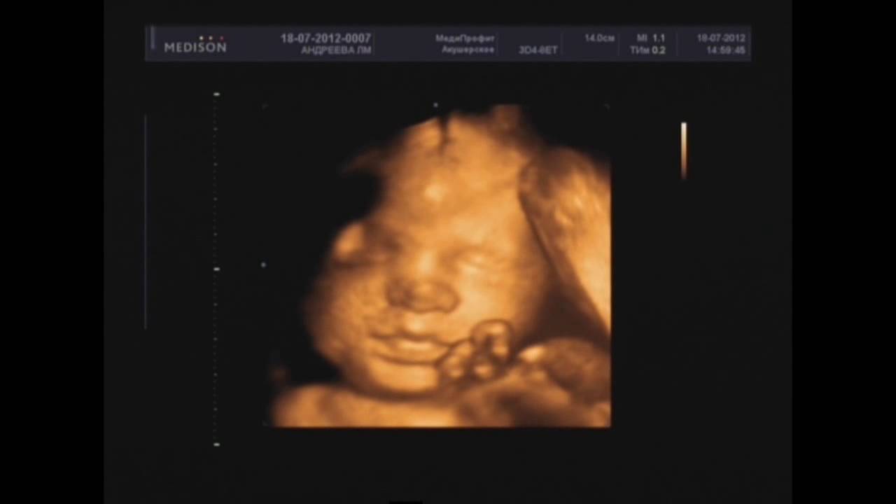 30 недель беременности фото малыша